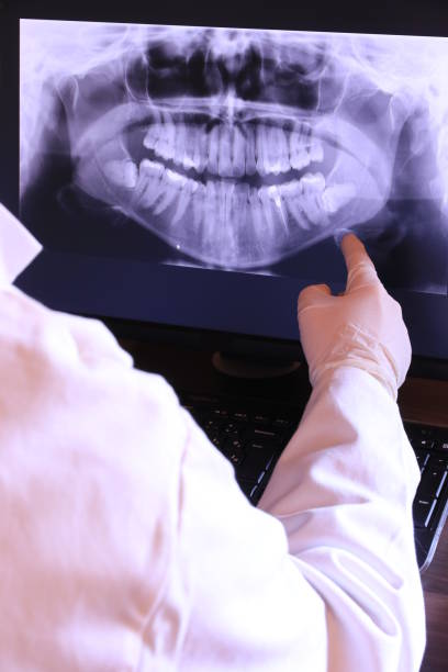 Best Walk-In Emergency Dentist in Sturgeon, MO
