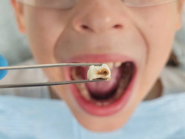 Best Pediatric Emergency Dentist in Sturgeon, MO
